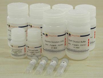 ChIP Assay Kit